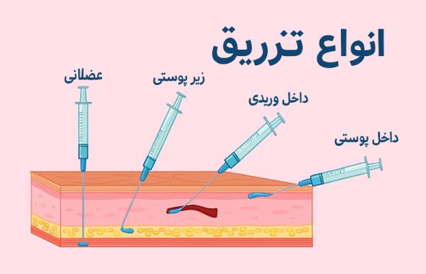 انواع تزریقات