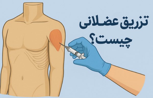 تزریق عضلانی چیست؟