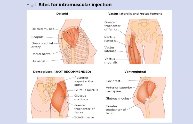 محل های تزریق عضلانی