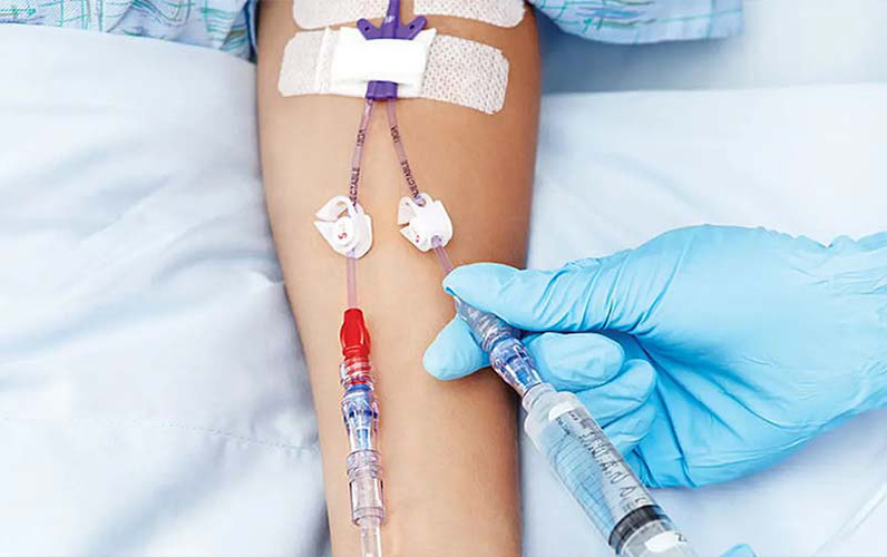 تزریق به داخل رگ