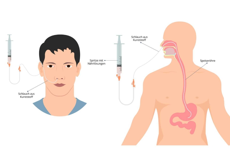 روش صحیح اتصال گاواژ