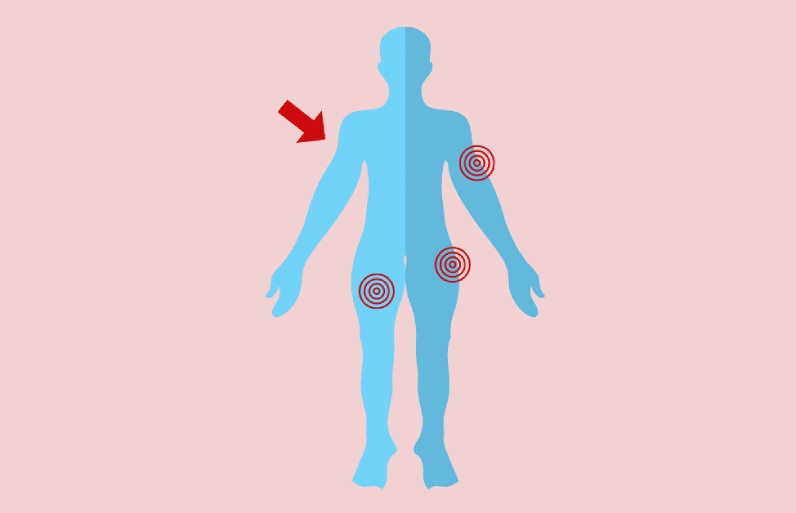 محل تزریق درست آمپول عضلانی