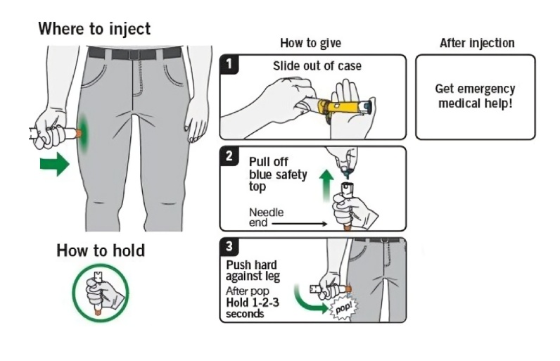 بهترین محل برای تزریق عضلانی اپی‌ نفرین