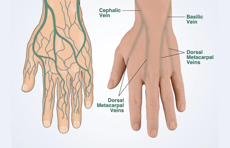 رگ های اصلی دست برای خونگیری