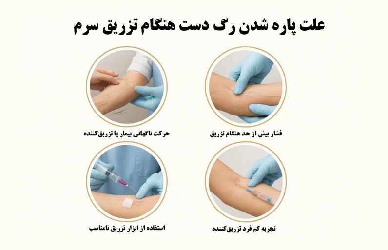 علت پاره شدن رگ دست