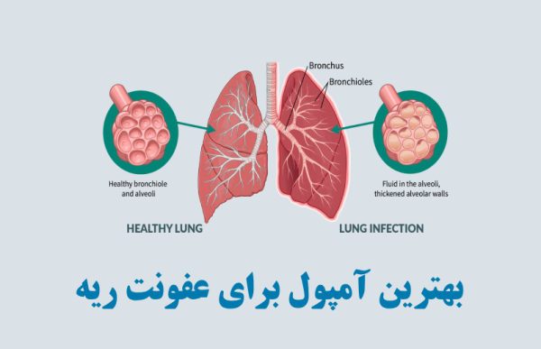 بهترین آمپول برای عفونت ریه