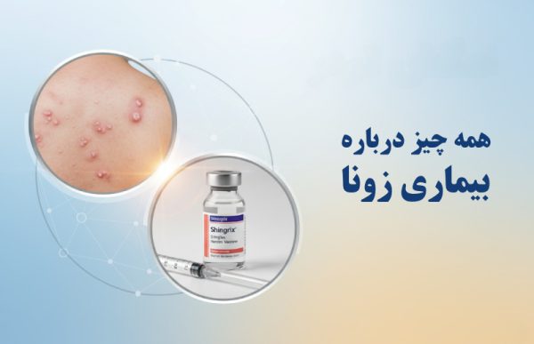 همه چیز درباره بیماری زونا