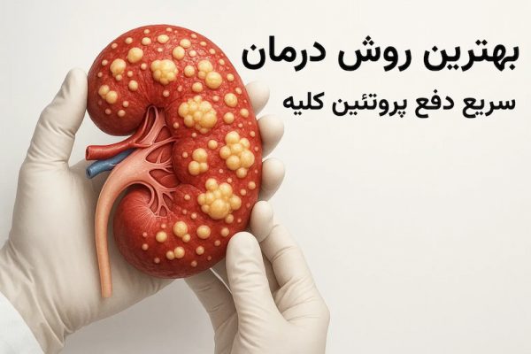 بهترین روش درمان سریع دفع پروتئین کلیه