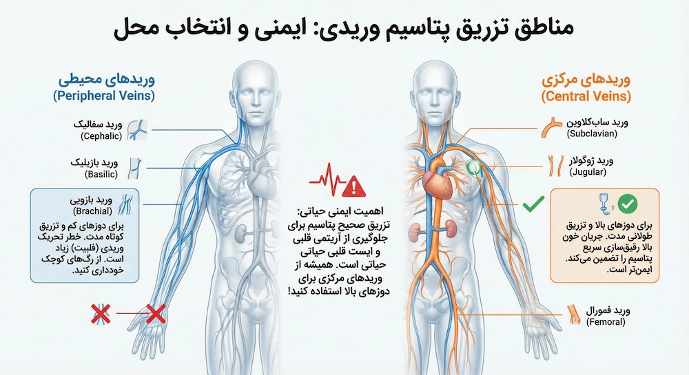 مناطق تزریق پتاسیم وریدی