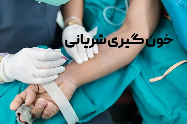 خونگیری شریانی