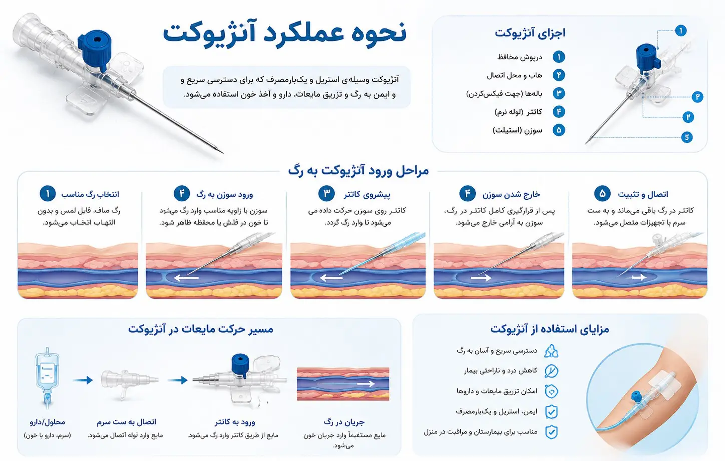 نحوه عملکرد آنژیوکت