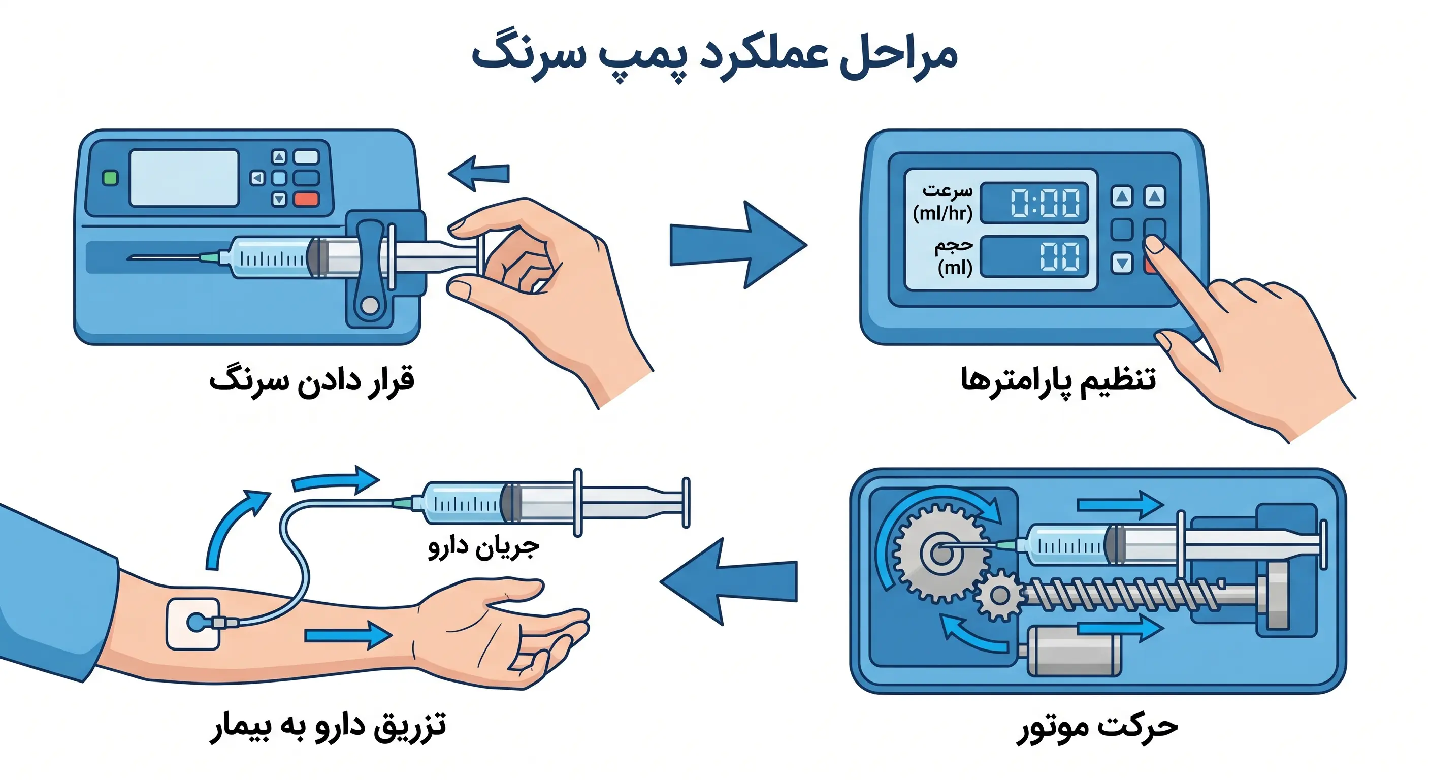 نحوه عملکرد پمپ تزریق