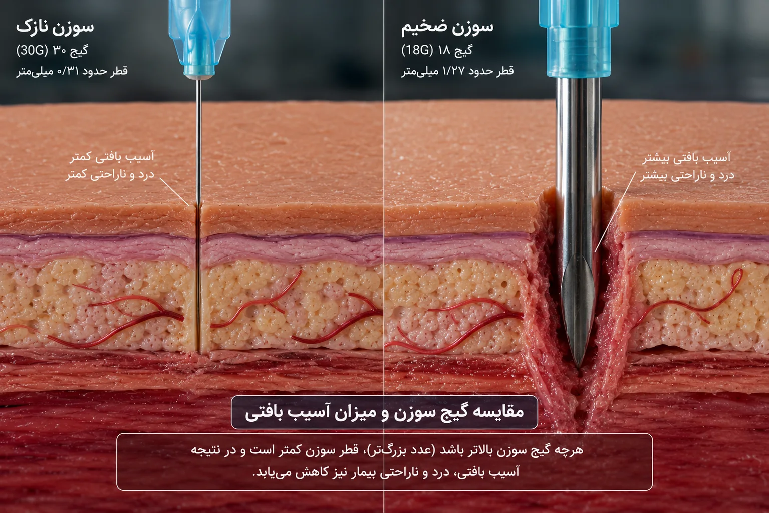 هر یک از انواع گیج سوزن در کدام قسمت از اعضای بدن استفاده میشود؟