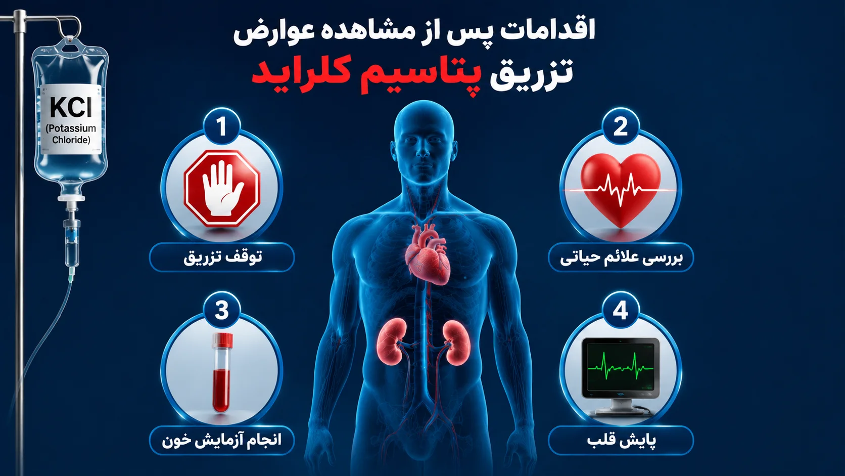 اقدامات لازم پس از مشاهده عوارض تزریق وریدی پتاسیم کلراید