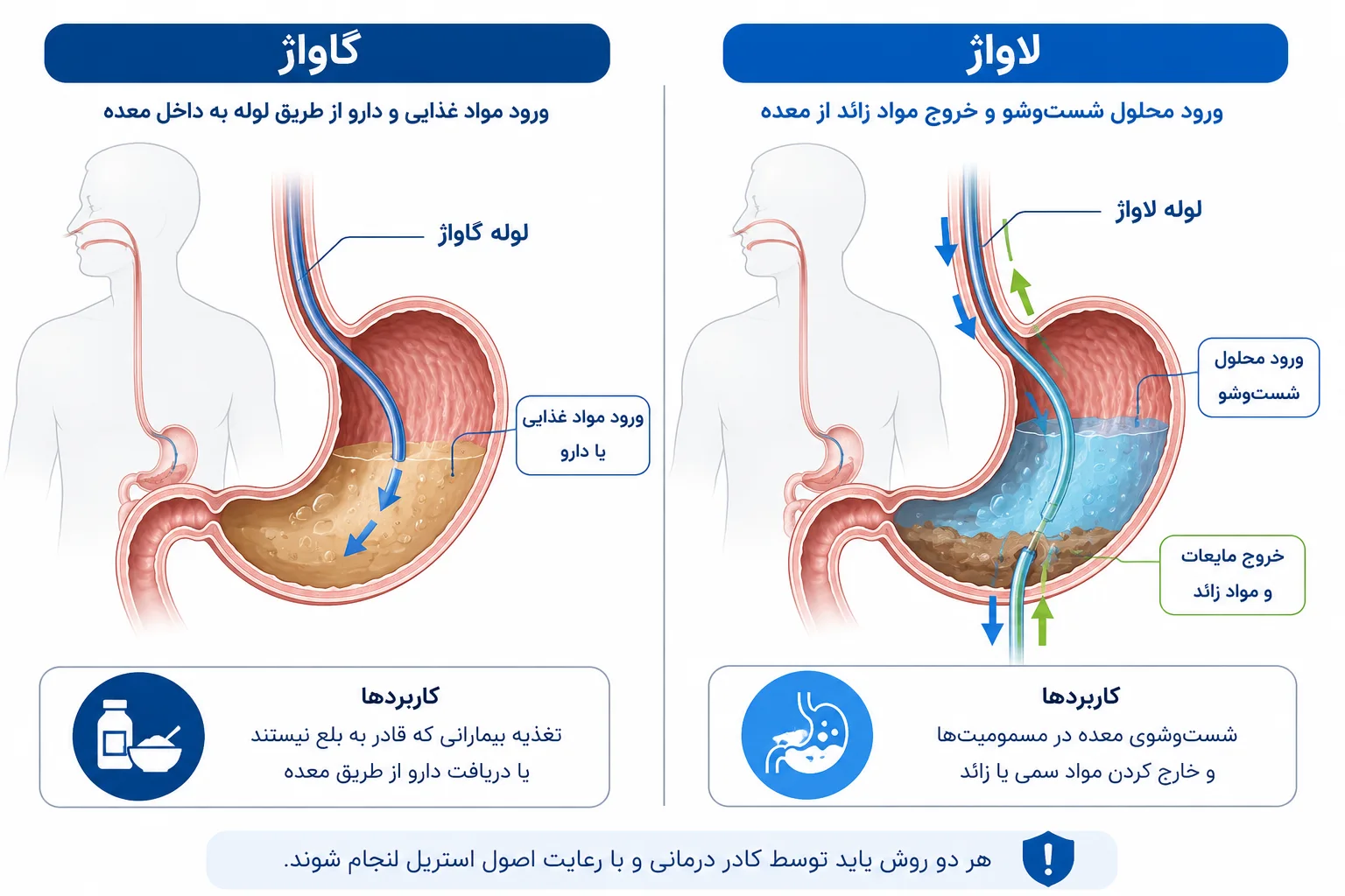 تفاوت اصلی میان گاواژ و لاواژ