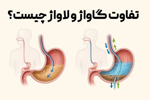 تفاوت گاواژ و لاواژ چیست؟