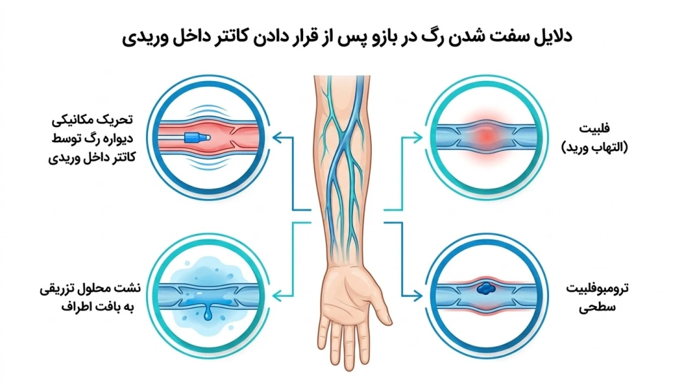 دلایل سفت شدن رگ دست