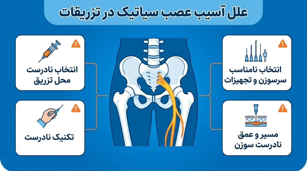 دلایل آسیب به عصب سیاتیک هنگام تزریق