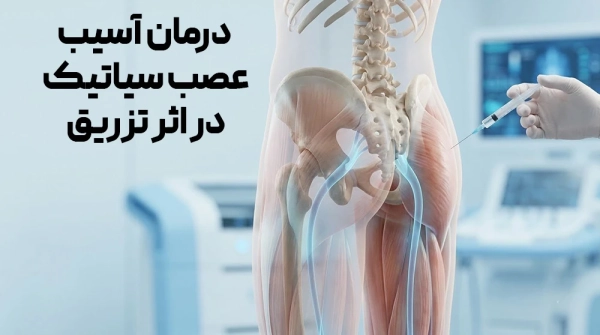 درمان آسیب عصب سیاتیک در اثر تزریق