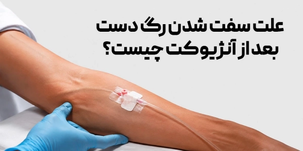 علت سفت شدن رگ دست بعد از آنژیوکت چیست؟