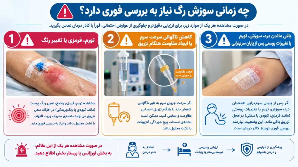 چه زمانی سوزش رگ نیاز به بررسی فوری دارد؟